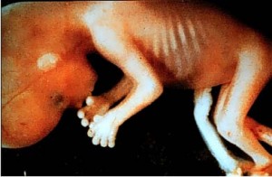 AbortionCounseling_9weekbaby